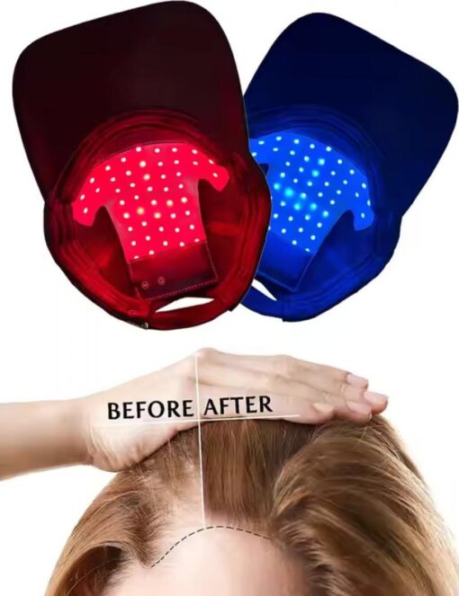 Chapeau casquette photothérapie luminothérapie LED lumière rouge et bleue pour la croissance des cheveux – Image 2