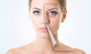 Etude clinique : bienfaits esthétiques de la luminothérapie sur la peau
